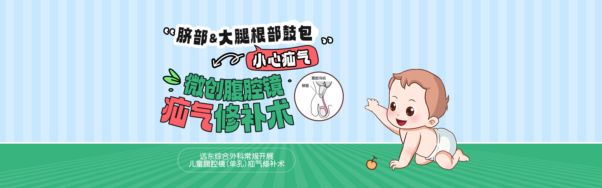 微创腹腔镜疝气修补术